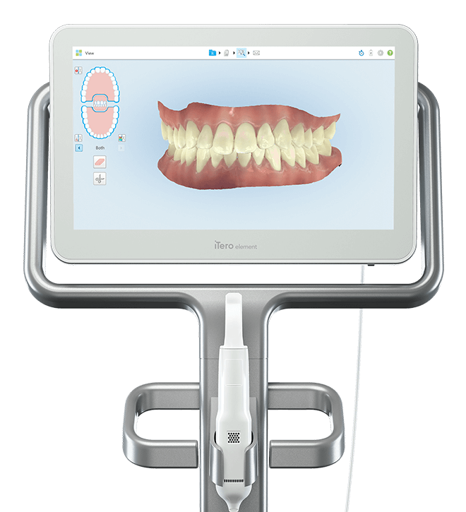 Checkup Digital odontologico