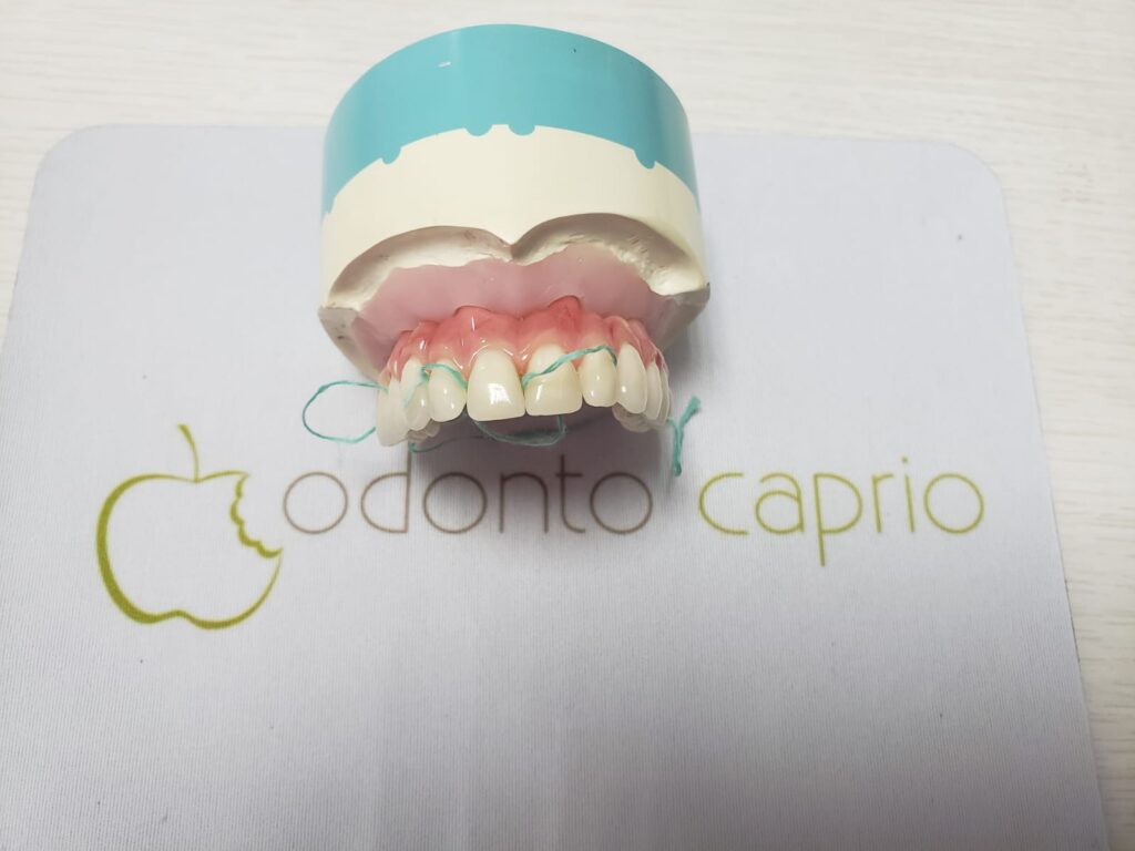Odonto Caprio - Prótese Dentária | Protocolo - Brooklin